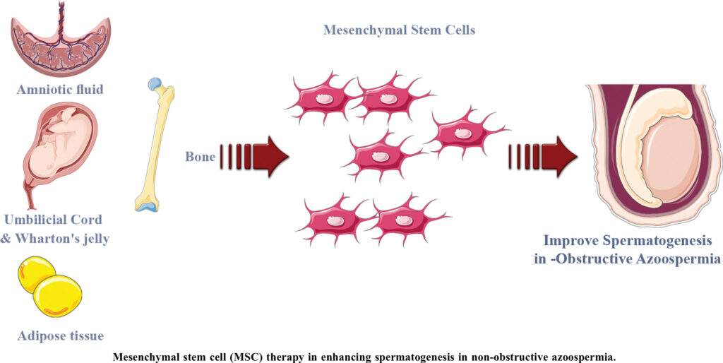 MSC Therapy for Infertility